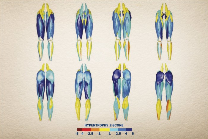 STRN_Springbok-Analytics_Muscle-scan